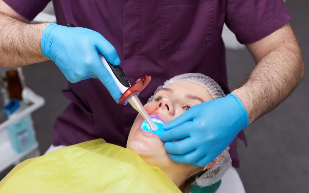 ¿Cómo se hace un empaste?