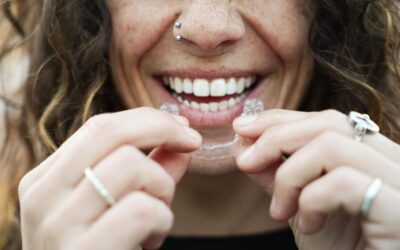 Todo lo que debes saber sobre los alineadores Spark