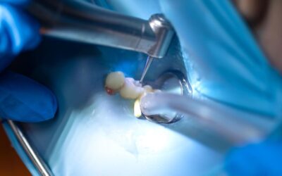Endodoncia y reconstrucción dental: todo lo que debes saber