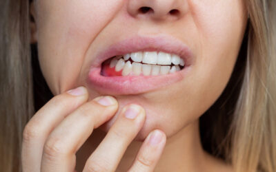 ¿Qué es la piorrea dental?