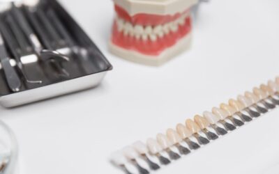 ¿Cuánto duran las carillas dentales?